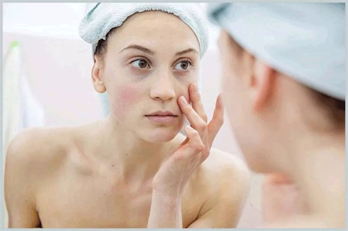 必备敏护敏感品推行榜的护强排荐抗过肤品肤质肤单
